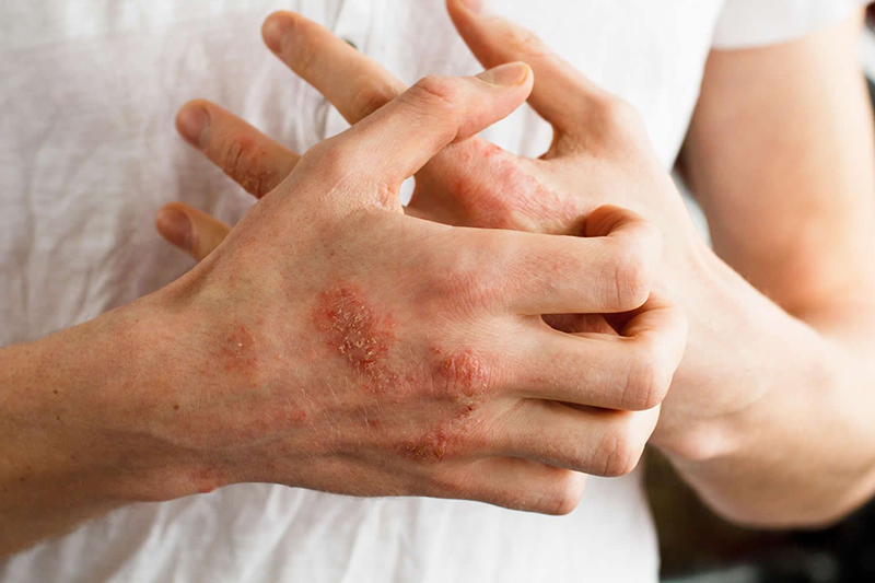 Vì làn da phải tiếp xúc trực tiếp với môi trường cho nên nguy cơ bị tác động, dẫn đến viêm nhiễm rất dễ xảy ra