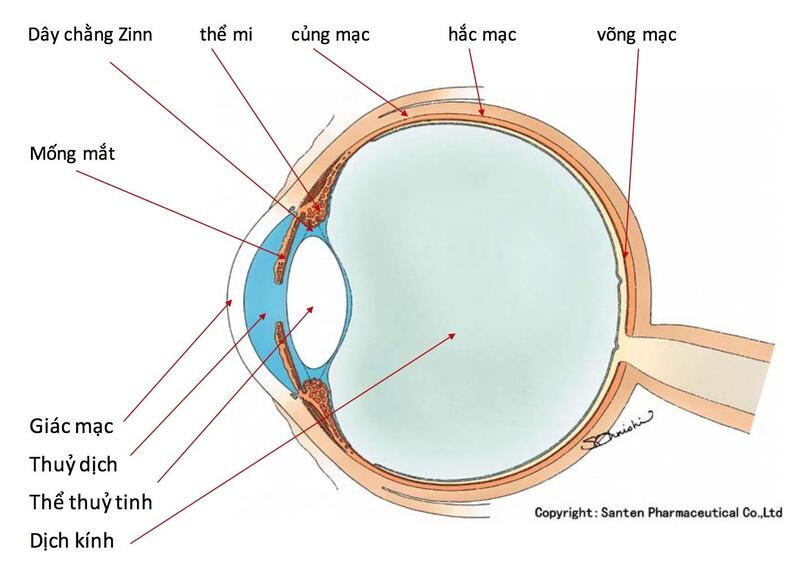 Đục thủy tinh thể khi nào cần phẫu thuật