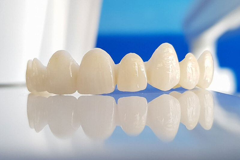 Bọc răng sứ giữ được bao lâu và hướng dẫn chăm sóc sau bọc răng | Medlatec