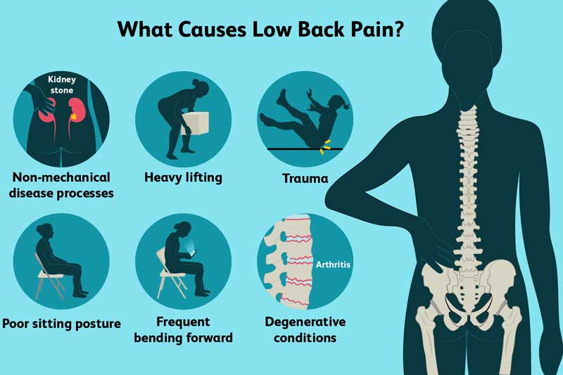 Cột sống thắt lưng đau do tình trạng thoái hóa