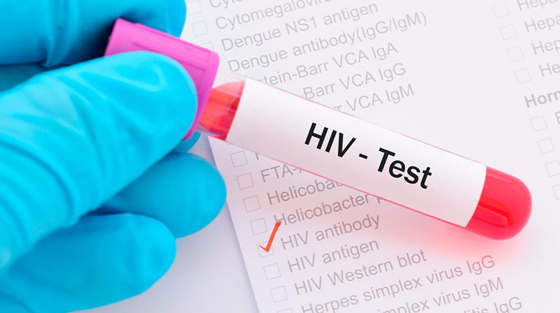 Thực hiện xét nghiệm HIV ngay khi nhận ra các dấu hiệu HIV giai đoạn đầu để ngăn chặn nguy cơ lây nhiễm ra cộng đồng