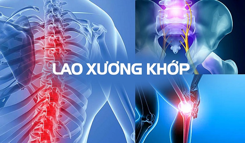 Lợi ích của việc tập luyện và phục hồi chức năng