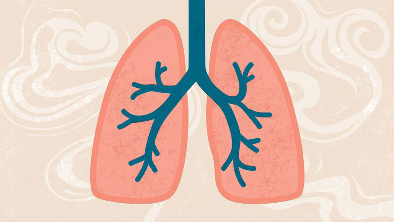 Viêm phổi do virus gây ra có thể dẫn đến hụt hơi