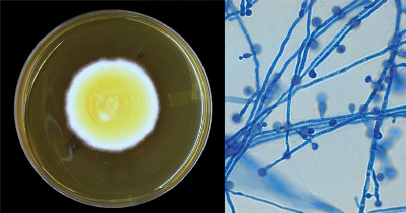 Nhiễm nấm Blastomyces