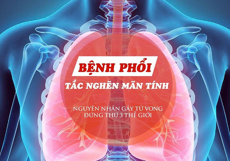 Chăm Sóc Bệnh Nhân Bệnh Phổi Tắc Nghẽn Mạn Tính: Hướng Dẫn Toàn Diện và Hiệu Quả