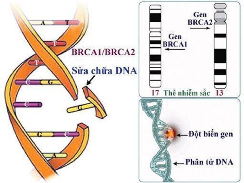 Xét nghiệm gen tìm ra đột biến BRCA1 và BRCA2 gây ung thư vú 