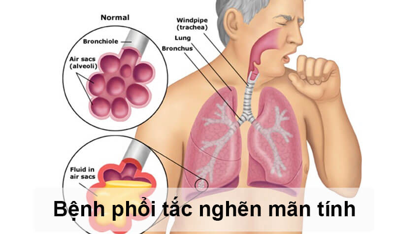 3. Phương Pháp Tập Luyện và Thể Dục