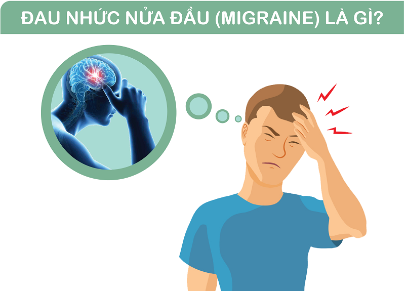 Đau đầu Migraine