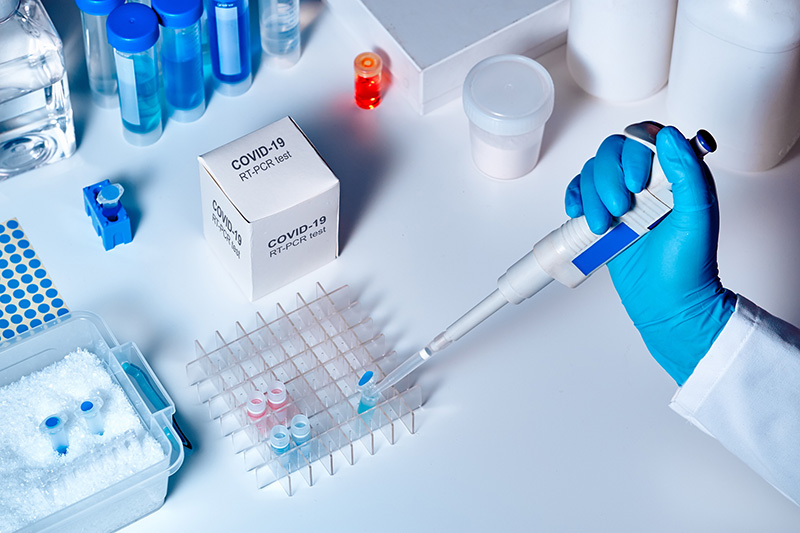 Thực hiện được xét nghiệm PCR COVID-19 cần có chuyên môn cao và thiết bị hiện đại
