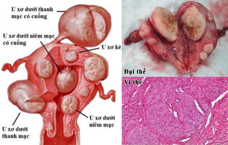 4. Phòng ngừa và quản lý sức khỏe