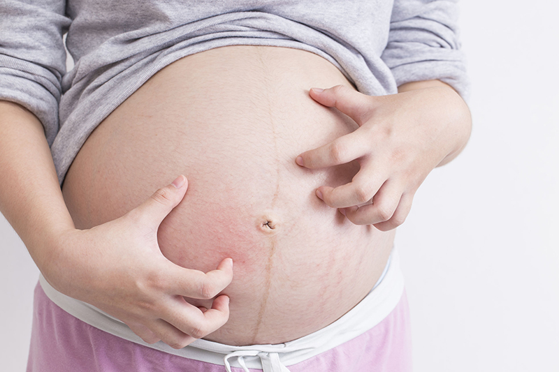 Một số trường hợp dị ứng khi đang mang thai và mức độ nguy hiểm
