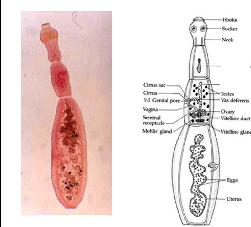 Nhiễm Echinococcus là bệnh do sán dây nhỏ gây bệnh