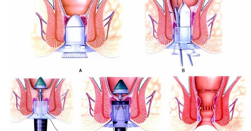 Công nghệ hiện đại được áp dụng vào quá trình phẫu thuật có thể góp phần giúp bệnh nhân phòng ngừa biến chứng trong quá trình hậu phẫu