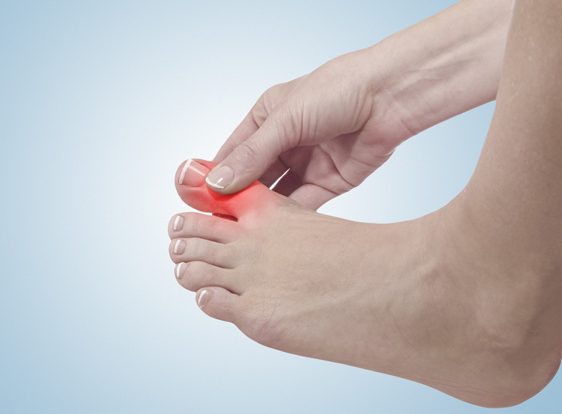 Cảnh báo nên biết: Sưng ngón chân là dấu hiệu của bệnh gì?
