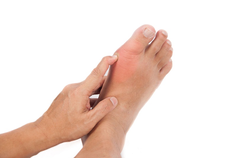 Người bị thoái hóa khớp thường có dấu hiệu sưng ngón chân