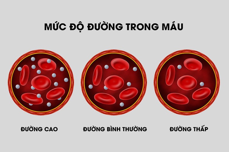 Đường huyết trong máu cao là dấu hiệu của bệnh tiểu đường