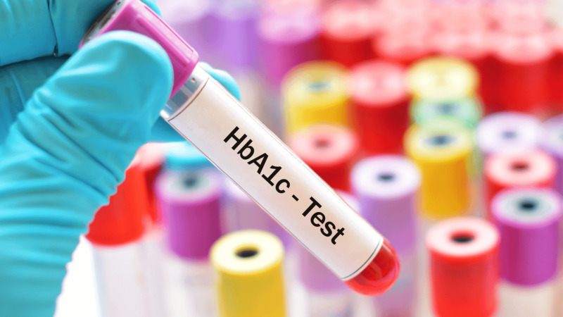 Xét nghiệm HbA1c cũng là một loại xét nghiệm đường huyết