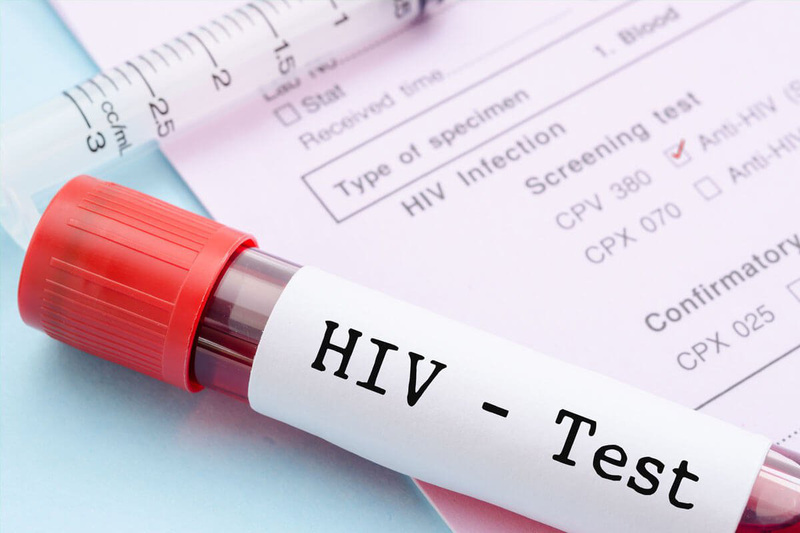 xét nghiệm hiv tại nhà