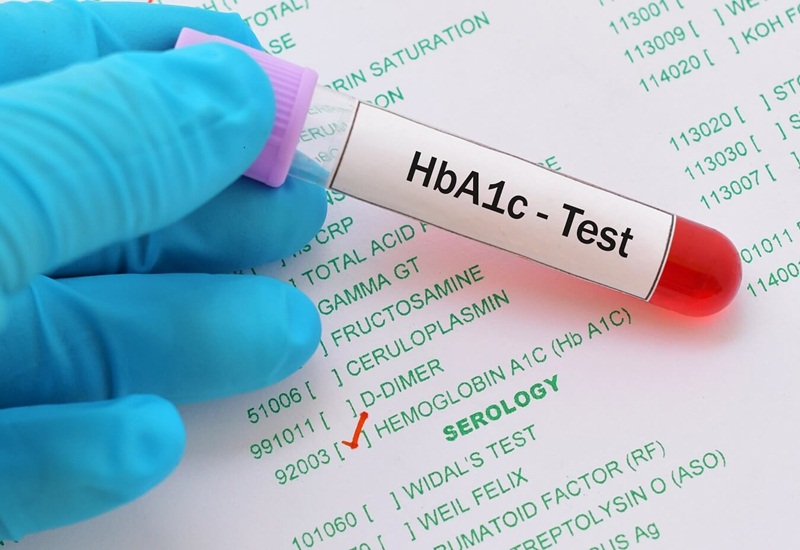 Chỉ số HbA1c ở người bị bệnh đái tháo đường có ý nghĩa ra sao?