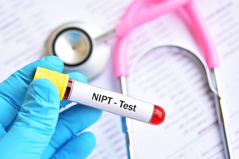 Xét nghiệm NIPT giúp sàng lọc sớm hội chứng Edwards