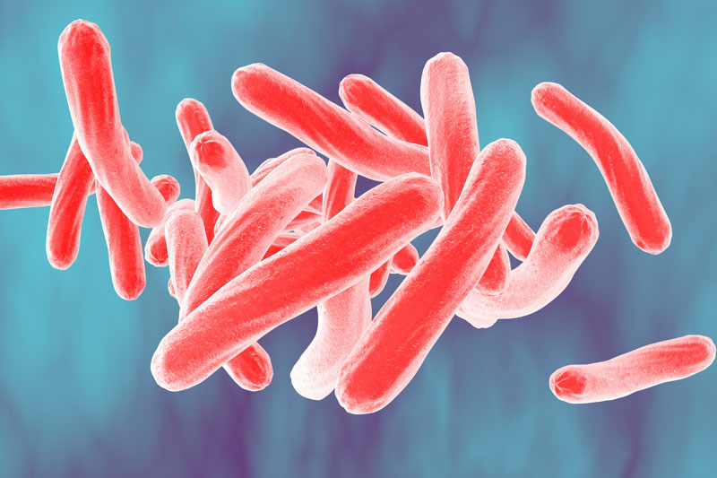 Trực khuẩn Mycobacterium tuberculosis là tác nhân gây bệnh lao xương khớp