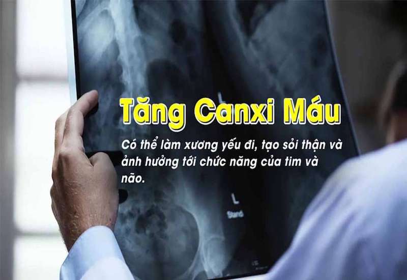 Các biến chứng nguy hiểm khi nồng độ canxi trong máu quá cao