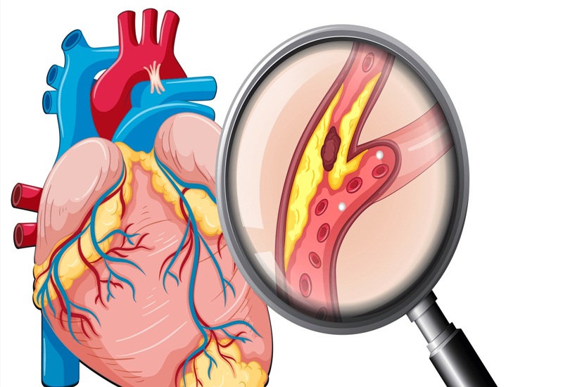 Protein dư thừa làm tăng nguy cơ mắc bệnh tim mạch