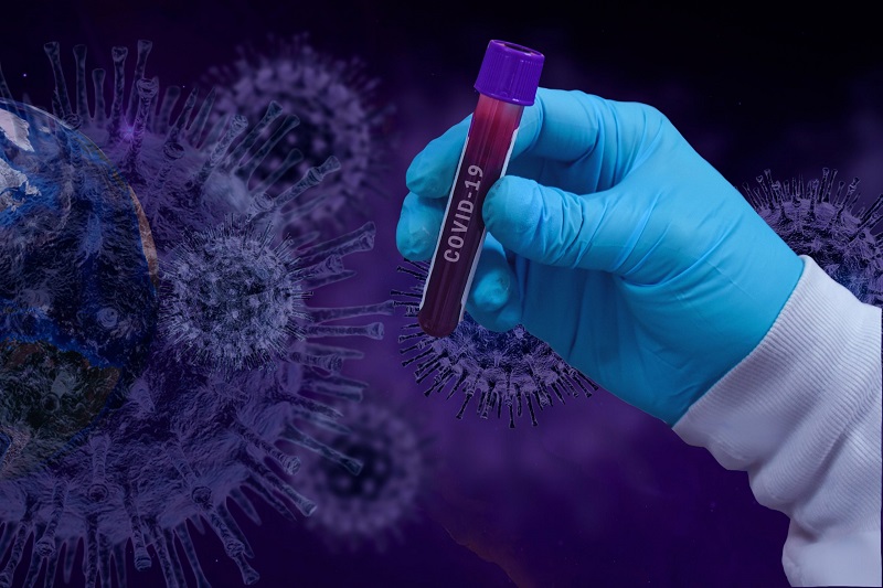 Định lượng kháng thể Covid-19 bao nhiêu là đủ để chống lại virus