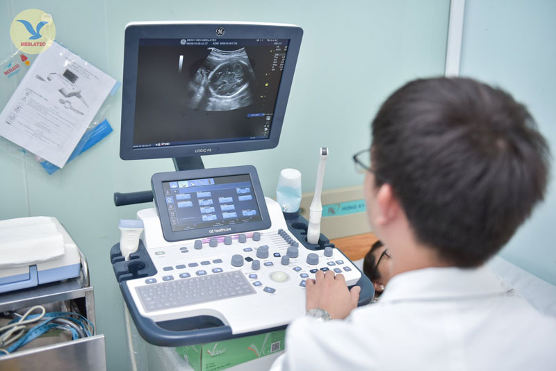 Đầu tiên trong quy trình sàng lọc trước sinh là siêu âm xác định có thai, nghe tim thai và phát hiện bất thường ở túi thai