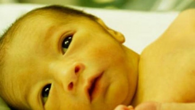 Chỉ số Bilirubin là cơ sở chẩn đoán nguyên nhân vàng da ở trẻ sơ sinh trong 24 giờ sau sinh