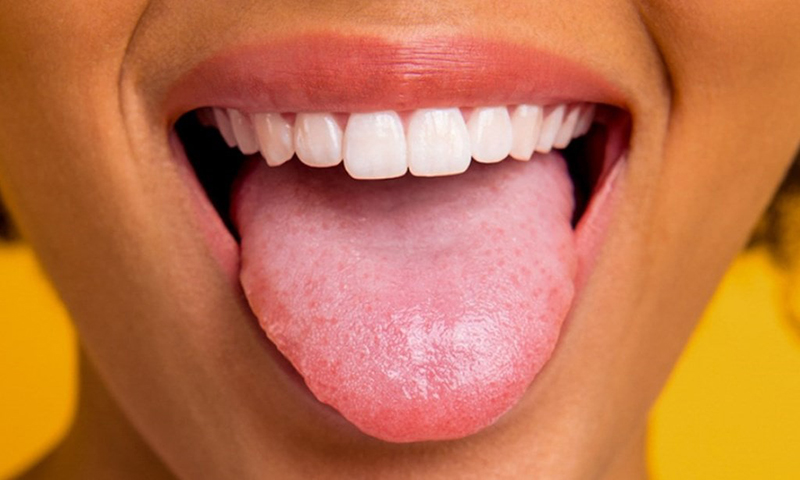Lưỡi bị trắng kèm hôi miệng: Nguyên nhân và cách điều trị | Medlatec