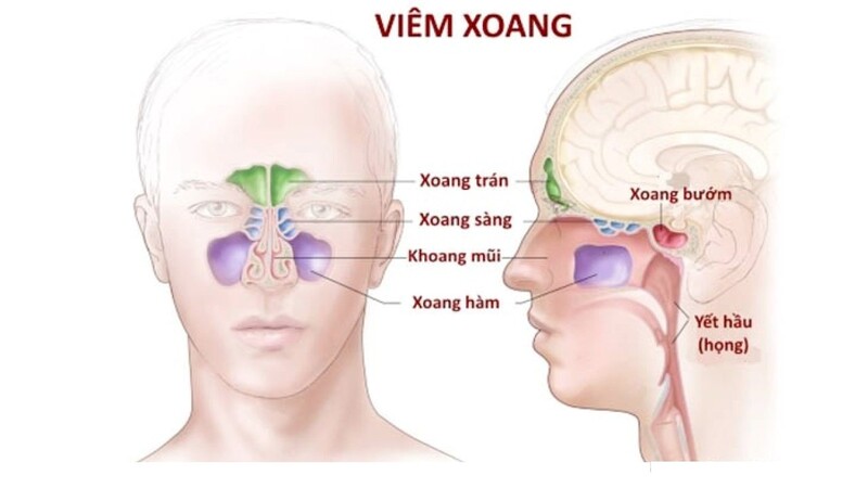 Các hốc xoang nằm trong khối xương sọ - mặt