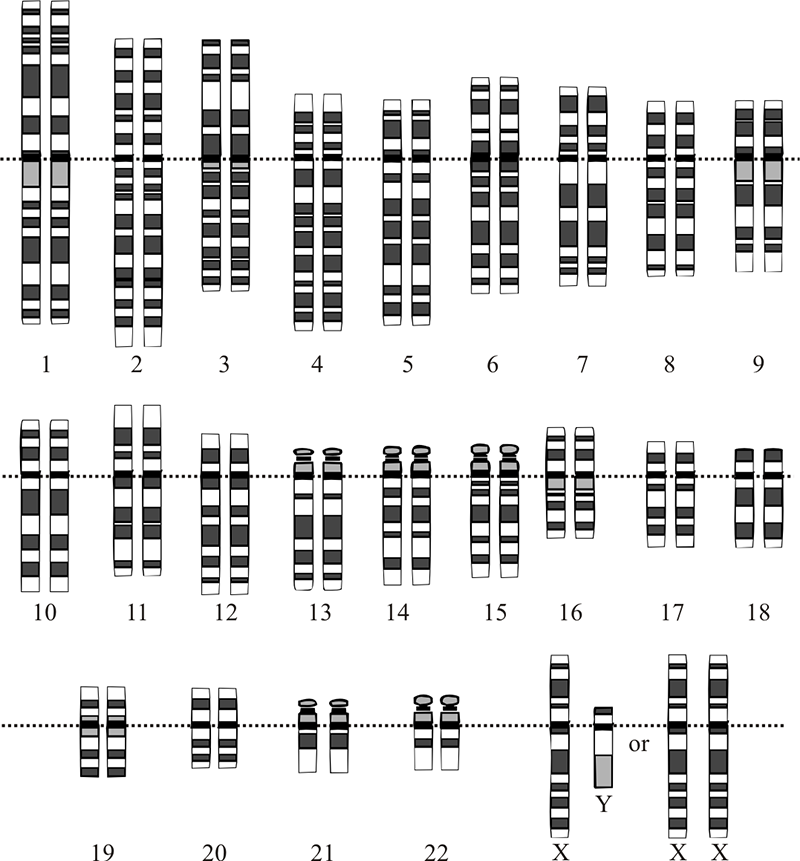 正常人有46条染色体