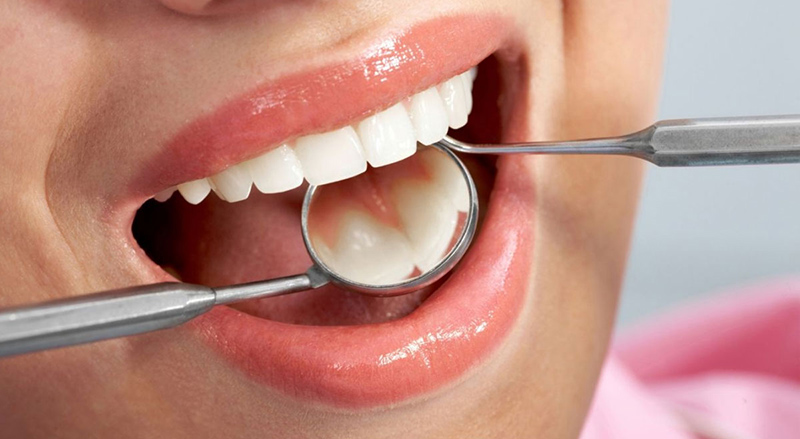 Chăm sóc sức khỏe răng miệng đúng cách là cách hiệu quả nhất để phòng ngừa viêm chân răng có mủ