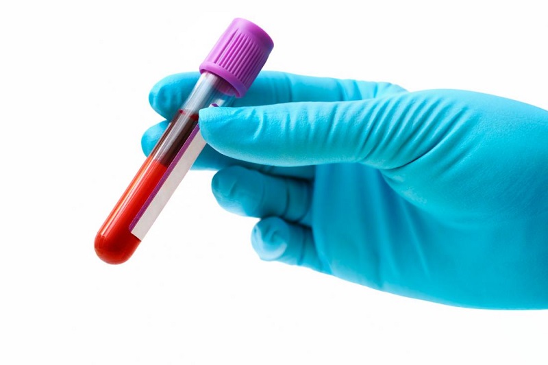 Xét nghiệm máu MCHC giúp xác định nồng độ huyết sắc tố trong máu
