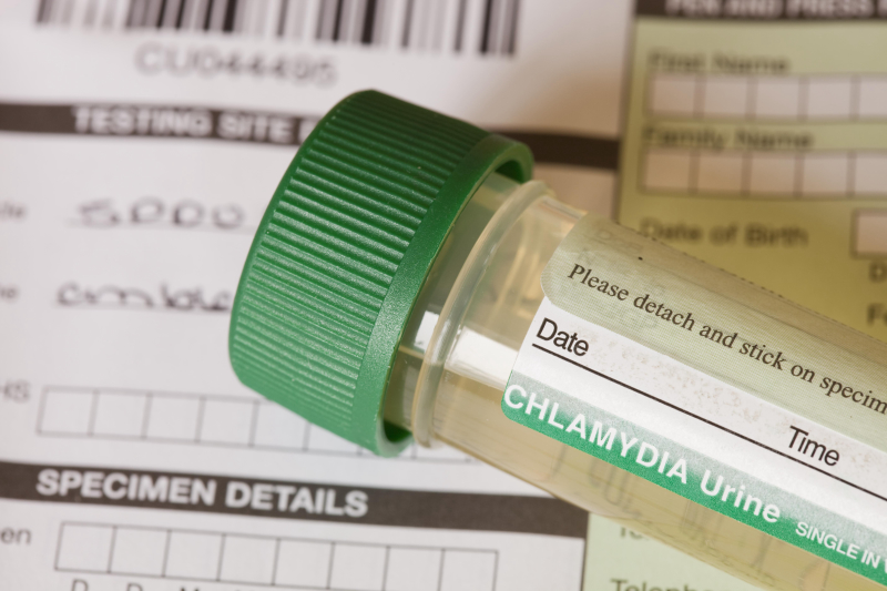Xét nghiệm Chlamydia đóng vai trò quan trọng giúp chẩn đoán và điều trị sớm