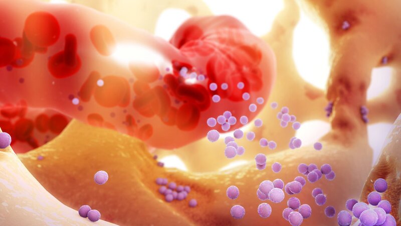 Bệnh về tủy xương có thể làm giảm khả năng sản xuất tế bào hồng cầu