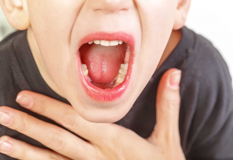 Viêm họng cấp có thể xảy ra ở trẻ em và người lớn