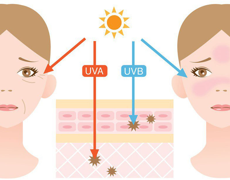 Tổng quan về các loại tia UV