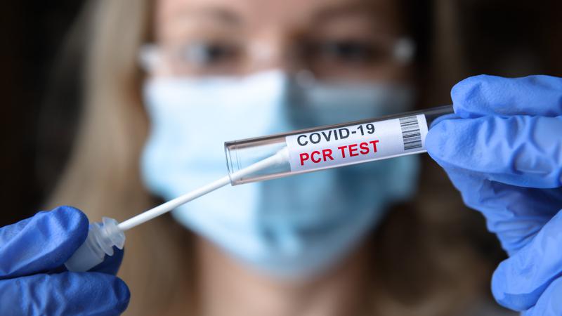 Giải đáp: Xét nghiệm PCR Covid bao lâu có kết quả quy trình thế nào?