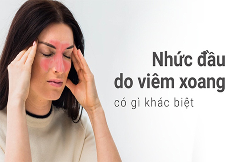 Viêm xoang thường gây ra triệu chứng đau nhức đầu