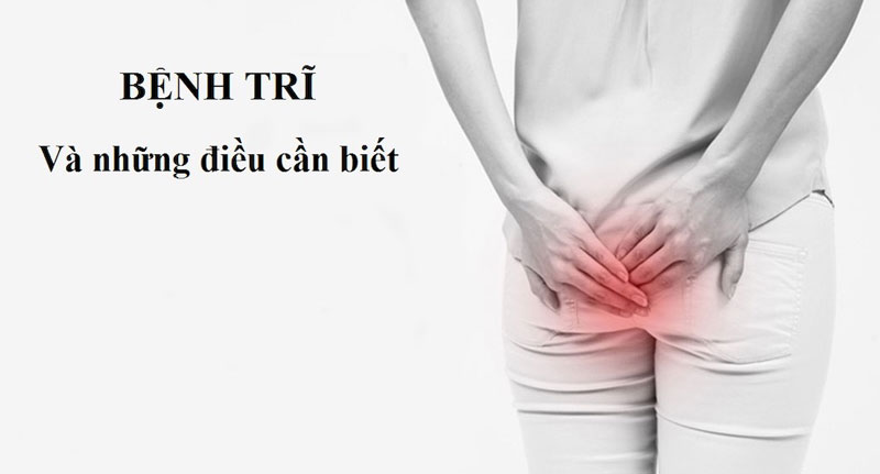 Bệnh trĩ là bệnh gì?