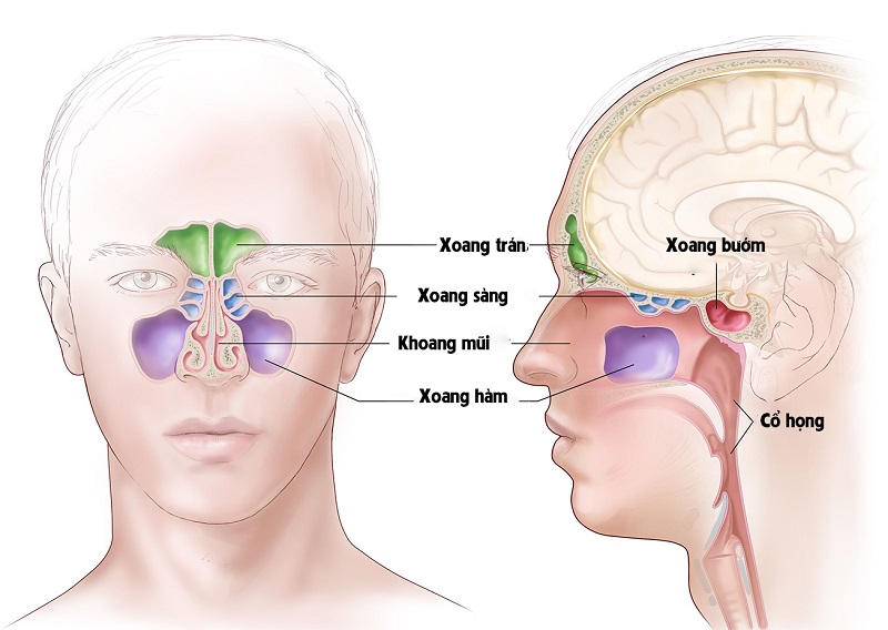 Lớp niêm mạc lót trong các hốc xung quanh mũi bị tổn thương dẫn đến viêm xoang