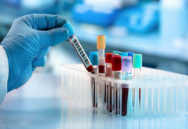 Chỉ số MCHC trong xét nghiệm máu là gì và có ý nghĩa như thế nào?