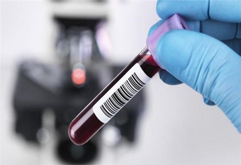 Xét nghiệm máu để xác định chỉ số RBC