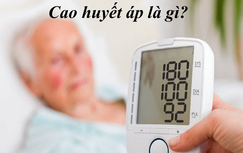 Huyết áp đo được vượt mức 140/90 mmHg được xem là cao