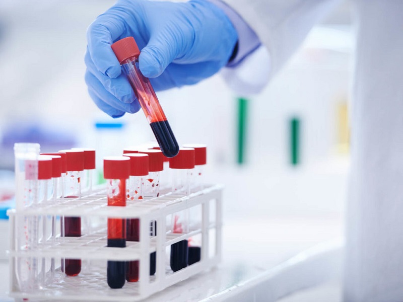 Xét nghiệm tổng phân tích tế bào máu giúp tìm ra nguyên nhân bị Anemia là gì