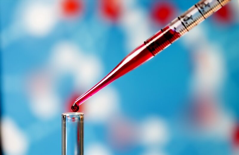 Xét nghiệm máu được thực hiện khi nghi ngờ nhân xơ tử cung gây chảy máu bất thường