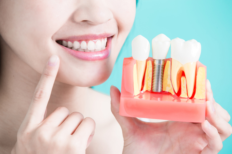 Cấy ghép implant giúp phục hình răng toàn diện, hoàn chỉnh như răng thật