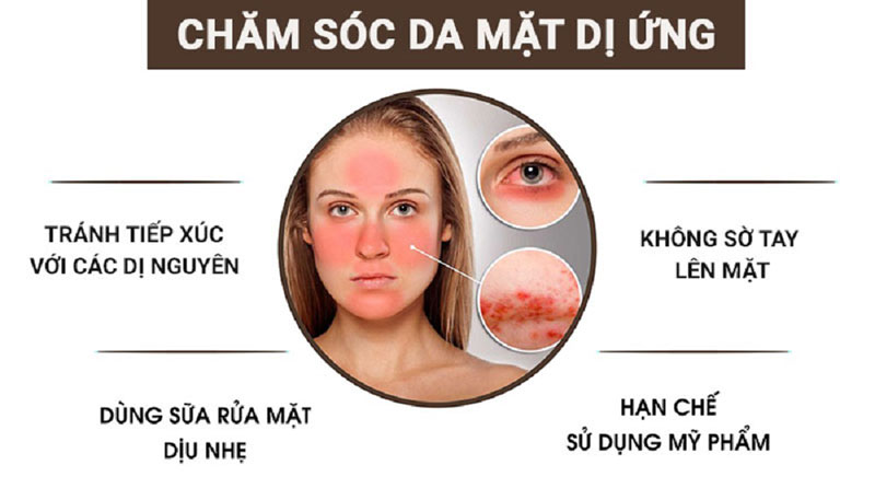 Nên chăm sóc da mặt như thế nào khi bị dị ứng